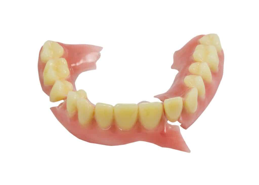 denture repairs